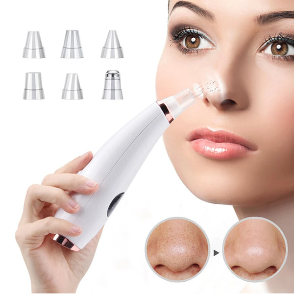 Pore Perfection Vacuum Cleaner